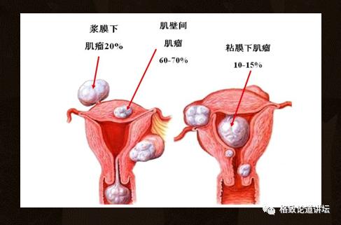 身为女人的我们如何保护好自己,作为人类我们如何保护地球