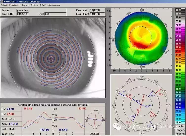 如何选择角膜塑形镜的品牌,怎么选角膜塑形镜的参数
