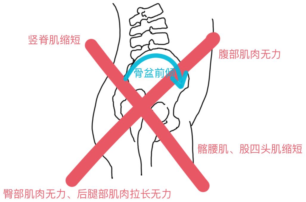 跑步后6个拉伸动作教你拉伸全身,跑步后胫骨前肌肉紧绷