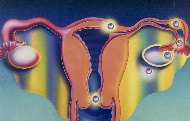 宫外孕成新晋孕产的四种习惯,宫外孕早期和先兆流产