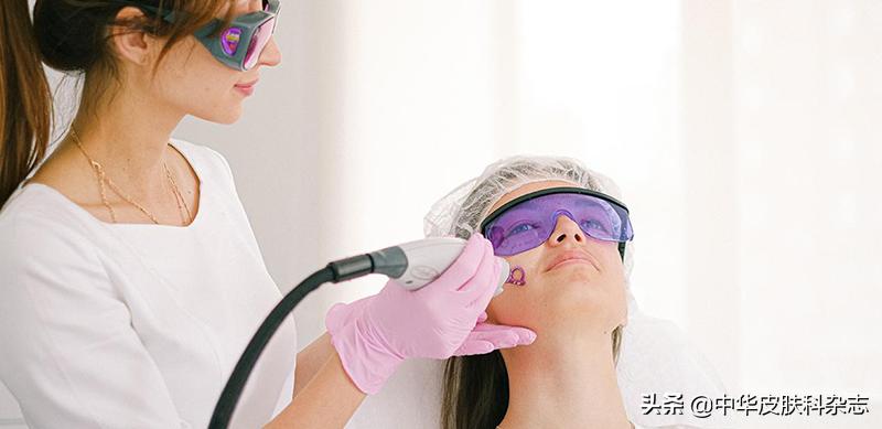 祛痘印痘疤最有用的药膏,激光祛痘印痘疤效果好吗
