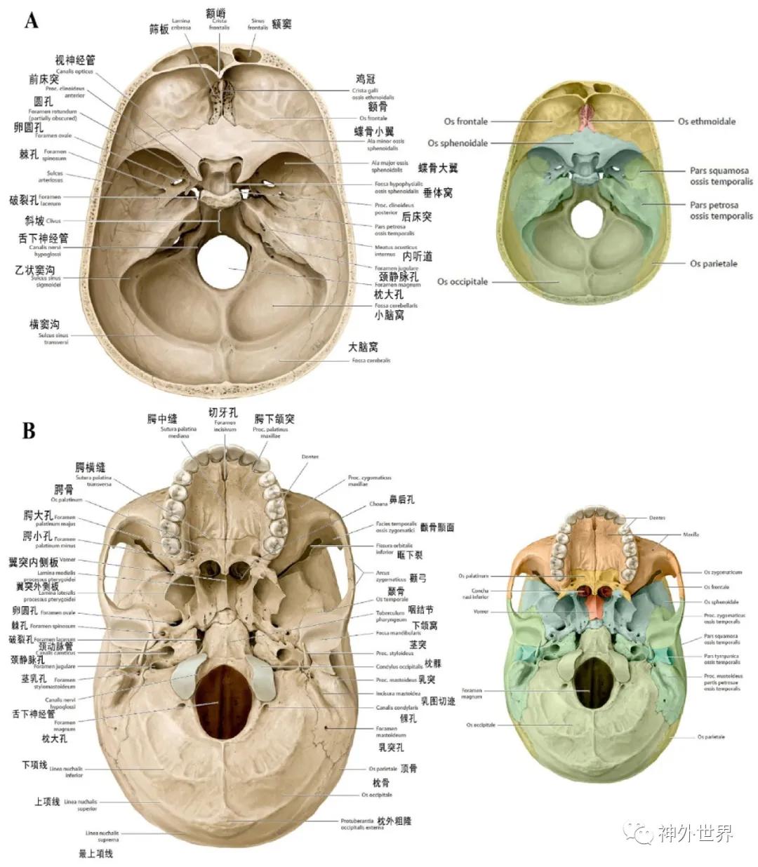 颅底骨折合并脑脊液漏伤情鉴定,颅底骨折伴脑脊液漏右眼眶骨折