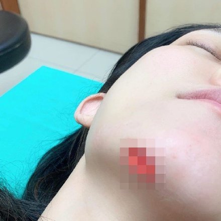 范玮琪下巴缝十五针，网友：“这是神的旨意，你可赶紧闭嘴吧！”