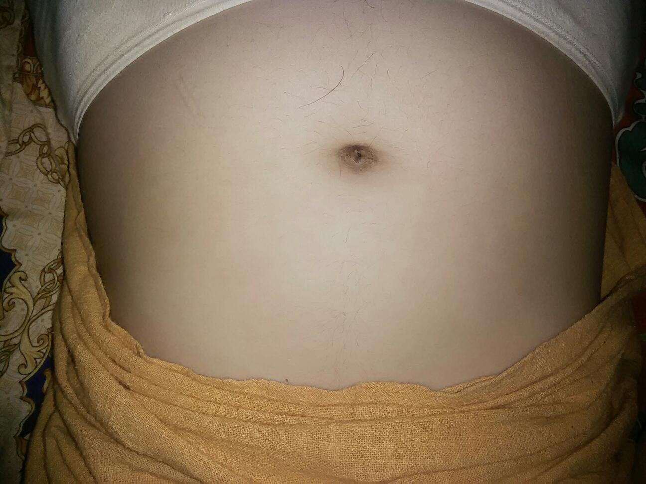 怀孕肚子长汗毛是什么原因,怀孕肚子长汗毛是怎么了