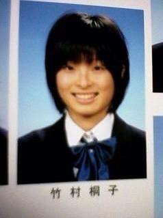 这个你察觉不到的小手术，滨崎步和80%的日本女星都做过它