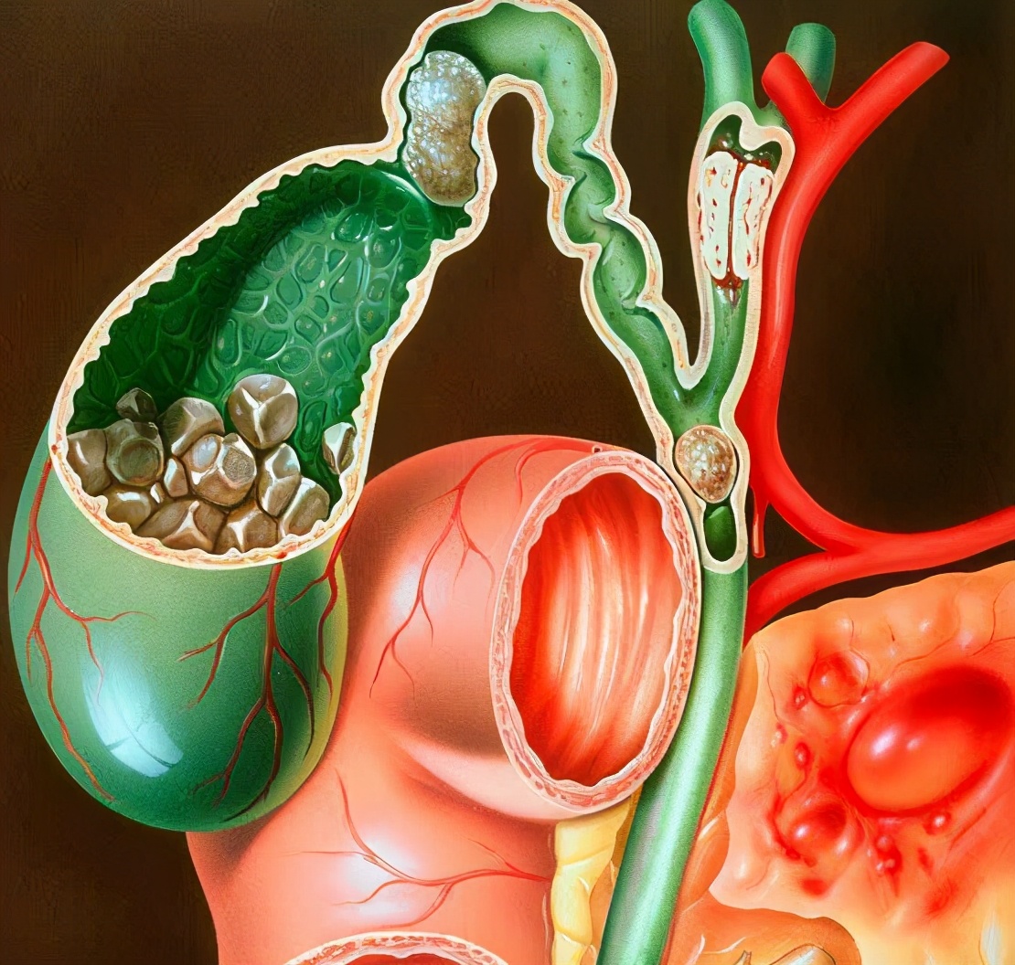 半夜2点到3点口干口苦是什么原因,凌晨2-3点醒是什么原因口干口苦