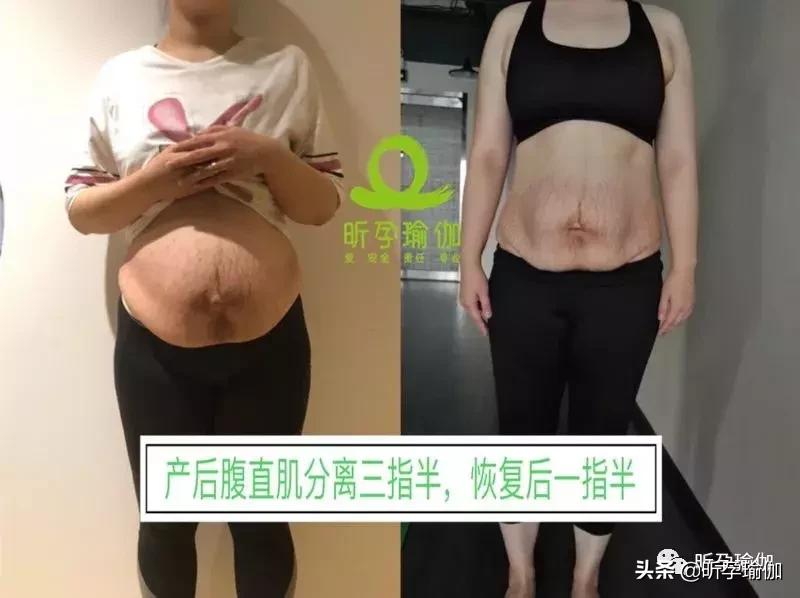 招聘全职孕产瑜伽老师