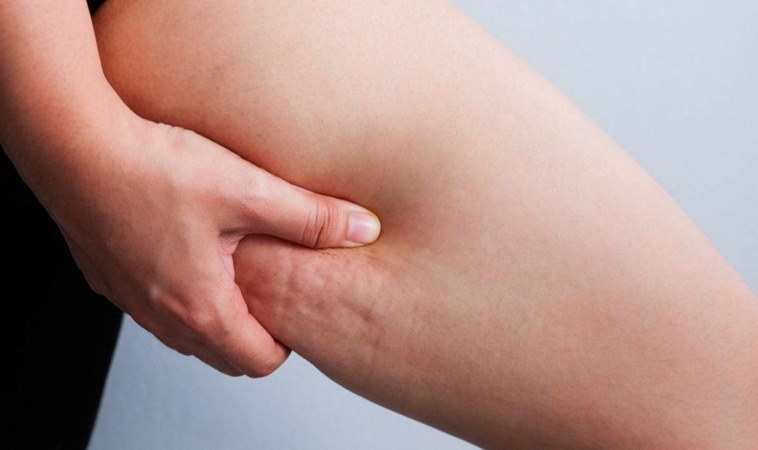 橘皮怎么样才可以保持长久,怎样消除橘皮现象