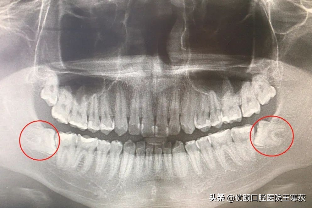 睡眠解决健康问题,睡眠解决一切问题