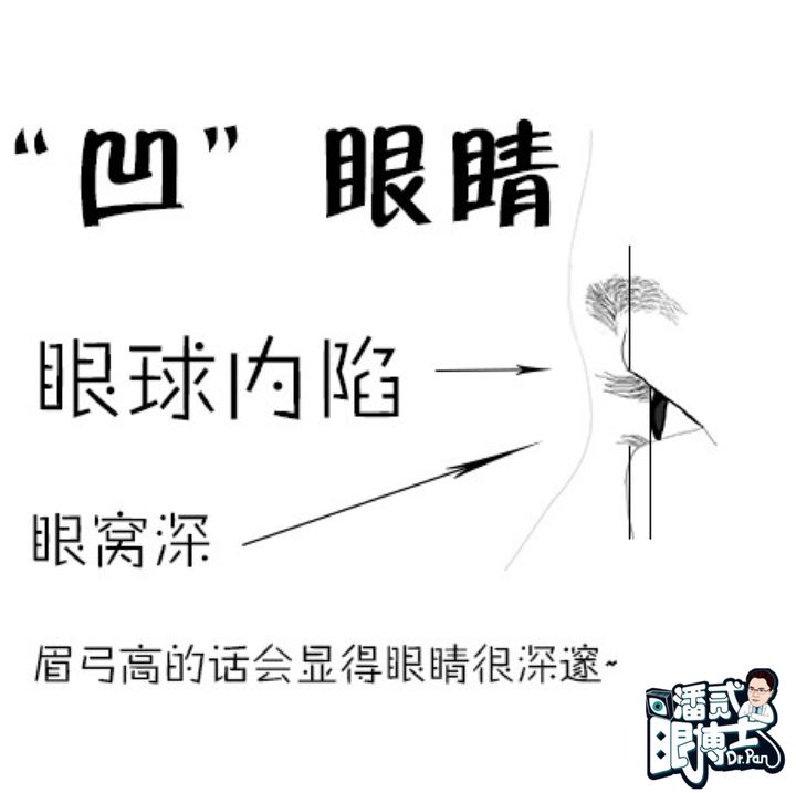 做外眼角改变到底大不大,开外眼角的手术后的图片