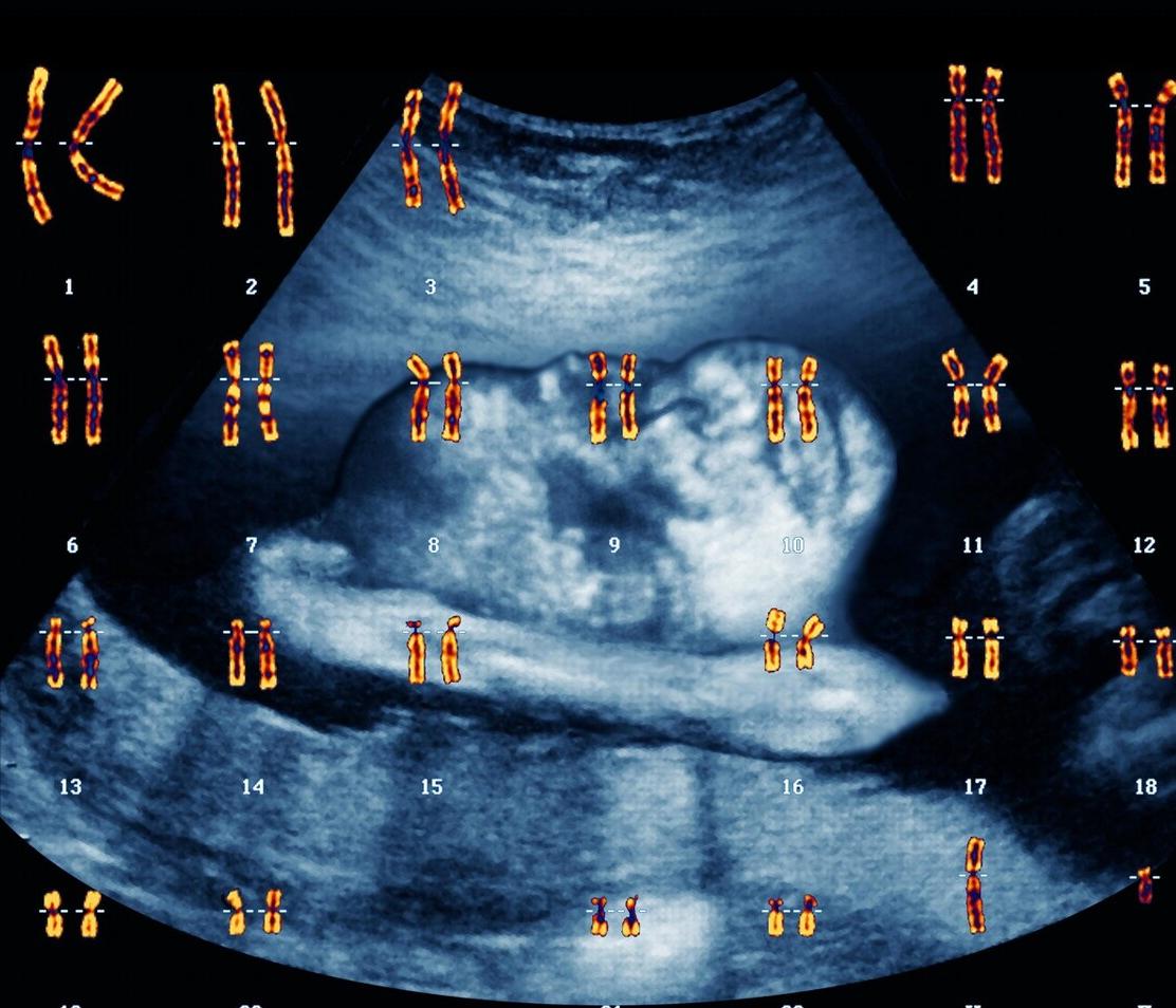 胚胎染色体异常可以要孩子吗,发生胚胎染色体异常的原因有哪些