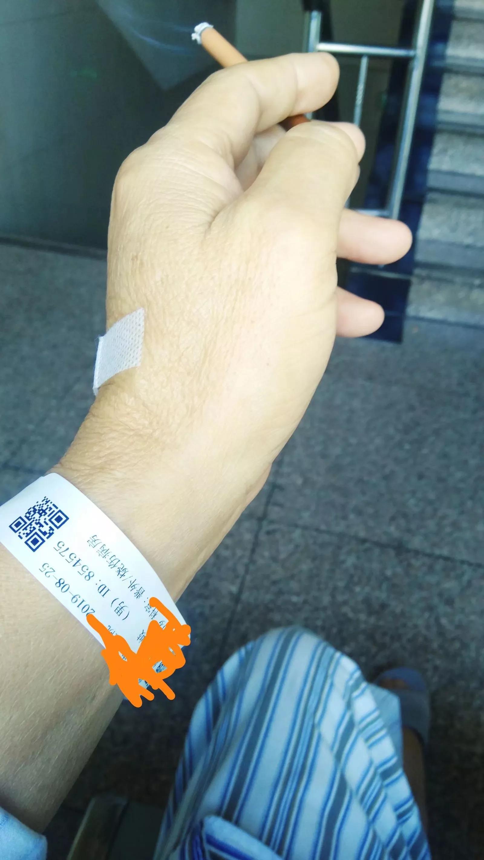 说说我刚经历的肛瘘手术