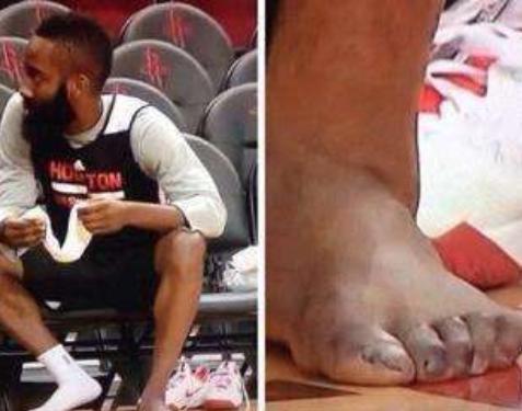 看了球员战脚还羡慕他们高薪资？老詹脚似外星人，大胡子脚像怪兽