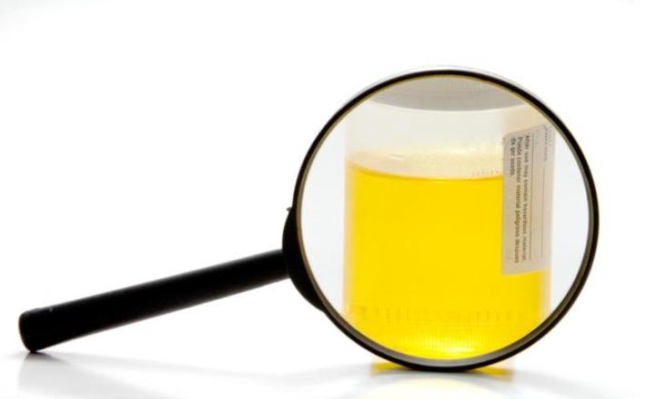 尿痛有哪些疾病,女性尿痛要警惕三种病