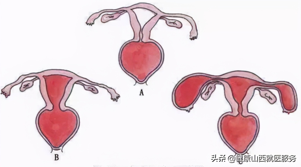 第一次*生活性**一定会流血？处女膜到底有啥作用？科普的解释来了