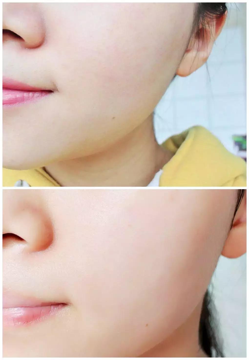 护肤太多的坏处有哪些呢,护肤越补越糟糕