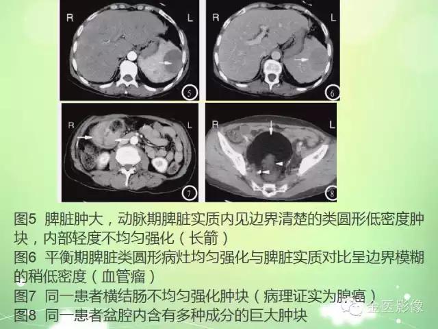脾血管瘤中医辨证,脾血管瘤超声表现