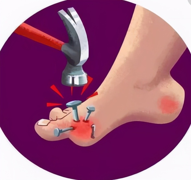 “东方美女”也是病？严重能夺命