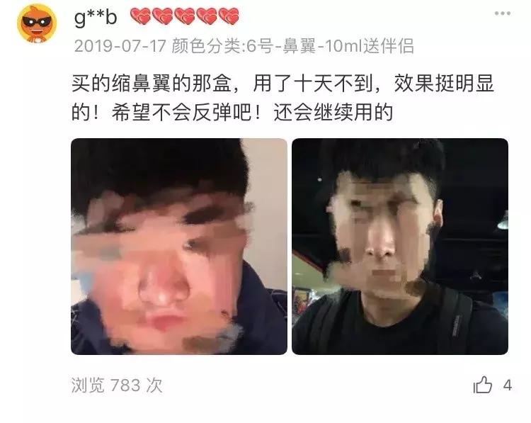 缩小鼻孔最简单有效的方法,怎么自由缩鼻孔