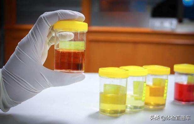 尿液中泡沫多是肾脏出了问题？夜尿增多又是为什么？