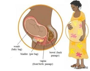 「盆底康复」被忽视的盆底让女人尴尬且难受