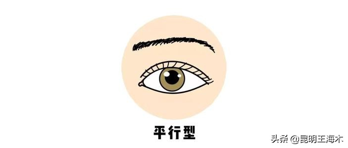 想做双眼皮先看看你适合什么方案,做双眼皮的三种方法你适合哪种