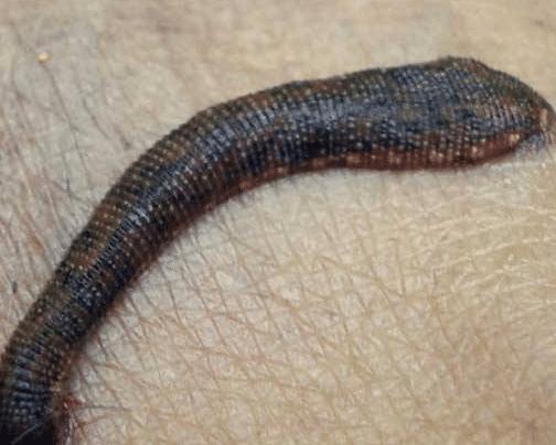 蚂蟥的生命力和繁殖能力是超强的,蚂蟥能不能在体内繁殖