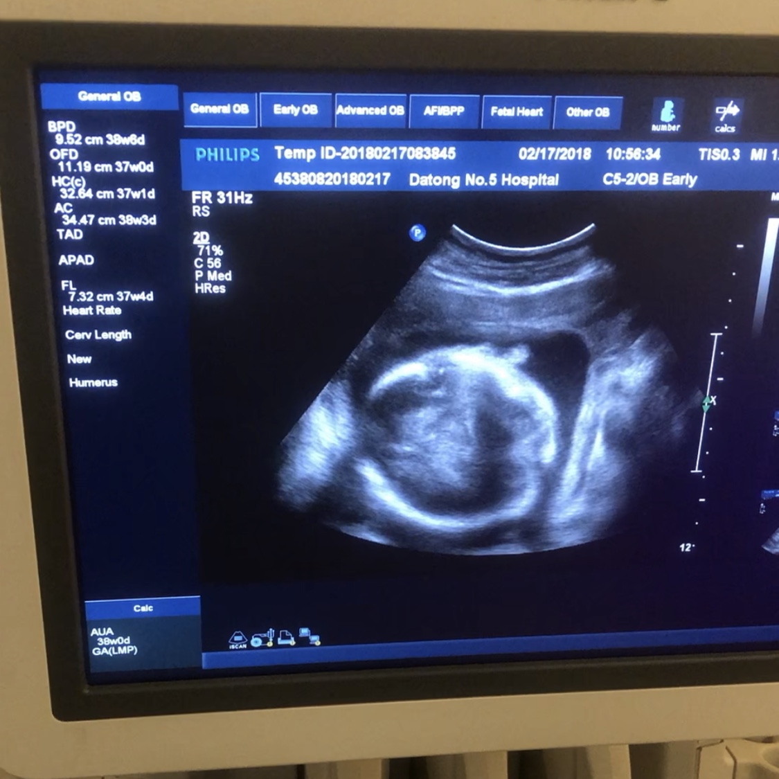 疫情期间，关于那些准妈妈的小疑惑