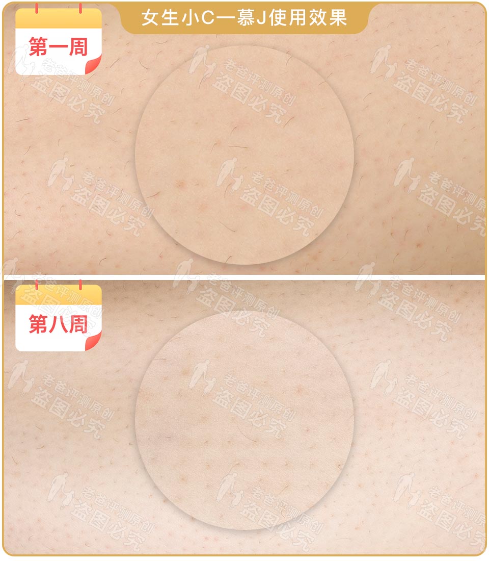 最真实的脱毛仪,bequeen脱毛仪实测