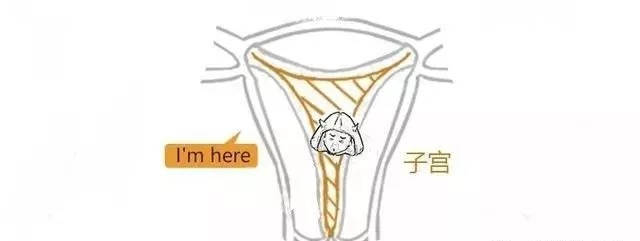 子宫肌瘤动漫演示,子宫肌瘤是什么原因导致的漫画