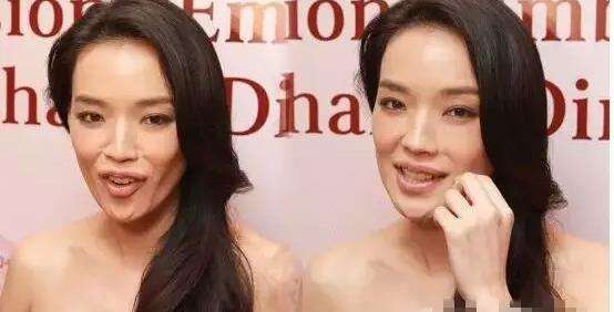 脸颊胶原蛋白补充,脸颊凹陷胶原蛋白流失如何补过来