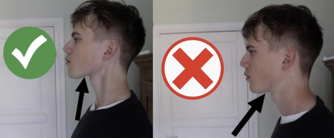 脸腮部又胖了,脸越来越胖脖子越来越粗