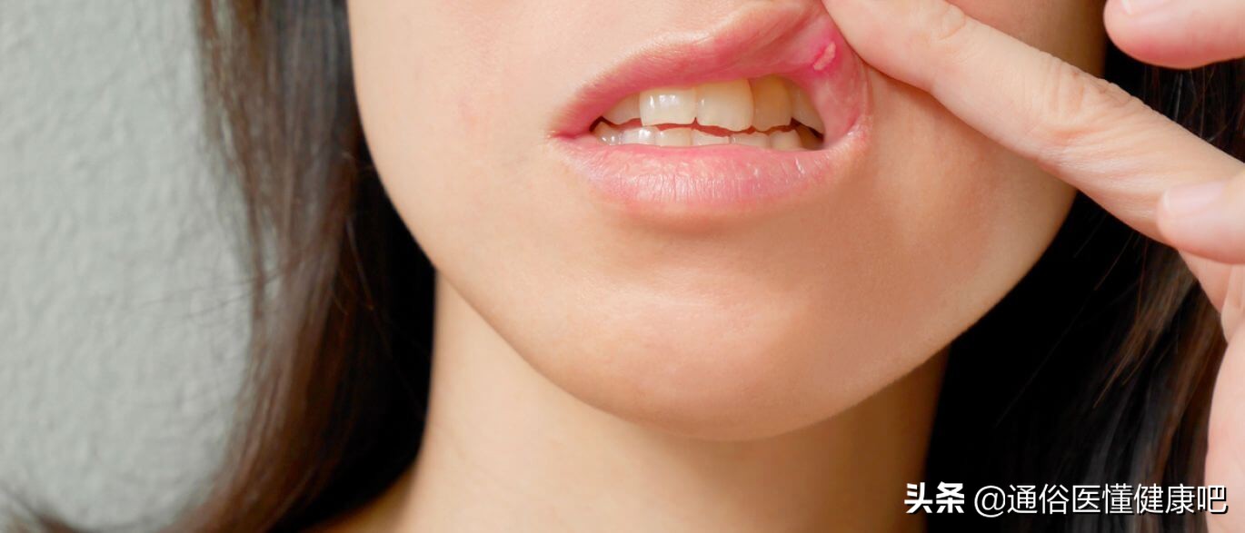 嘴巴破洞喝什么水,嘴破洞