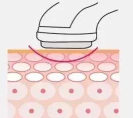 有什么是真正的美容仪,美容仪是用的什么原理