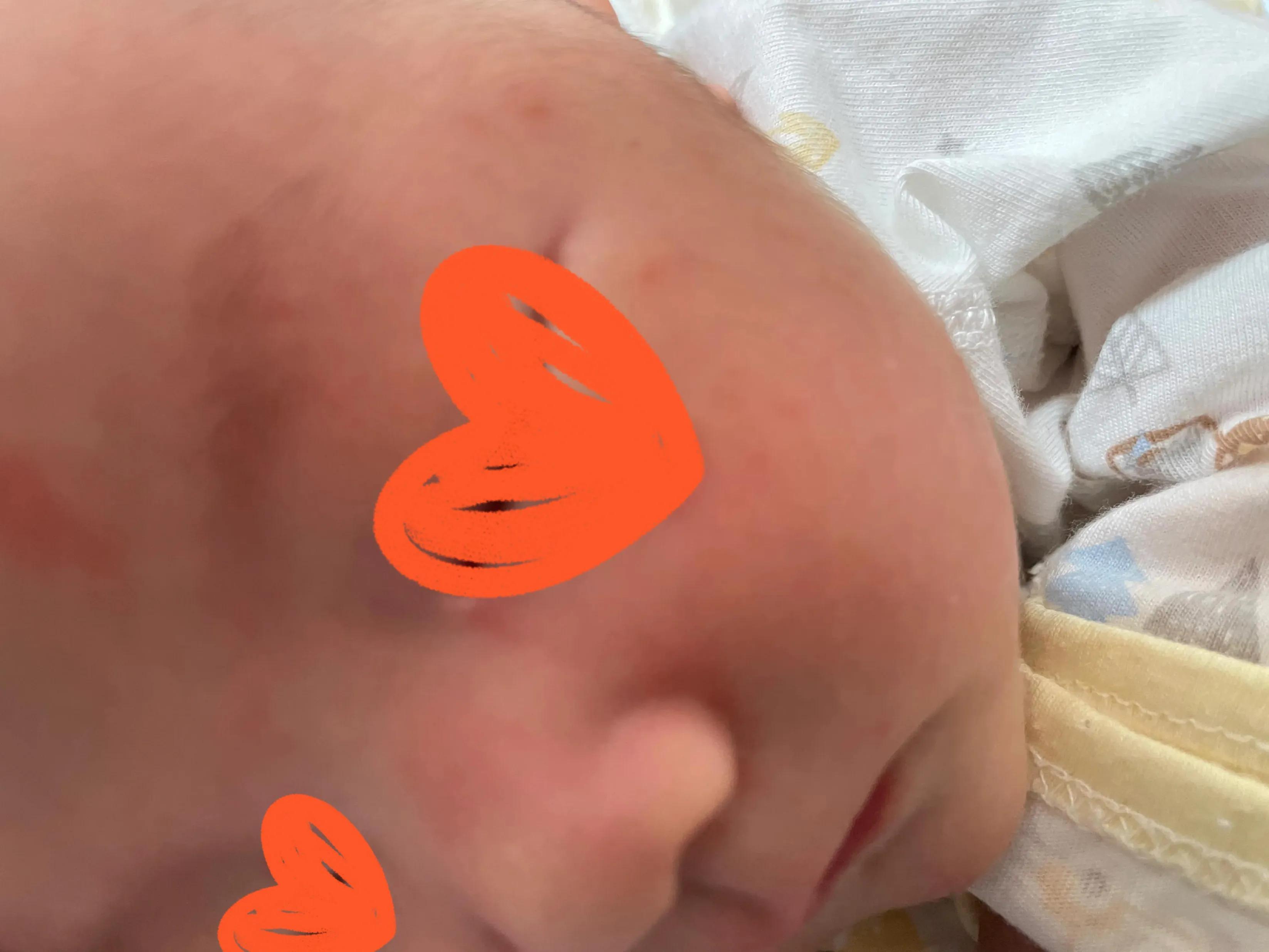 养宠物会不会造成孩子湿疹,孩子有干性湿疹能养宠物吗