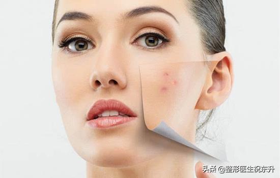 护肤的四个习惯毁掉你,给脸做护肤真的有必要吗