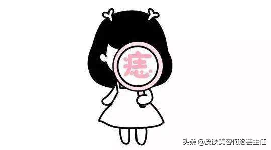 色素痣需要注意哪些事项,色素痣能怎么避免