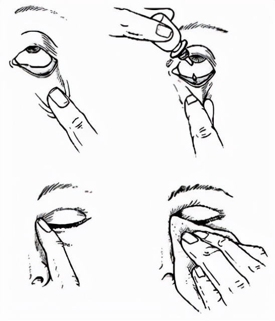 双眼无神怎么变得有神吃点什么,双眼无神怎么变得有神