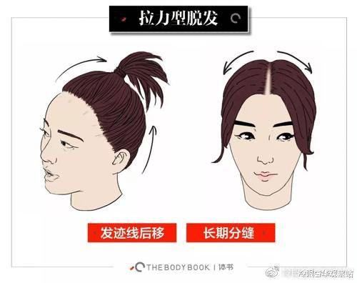 还在担心假发片翻车?复活发际线仅需几招,韩美娟直呼后悔才看到