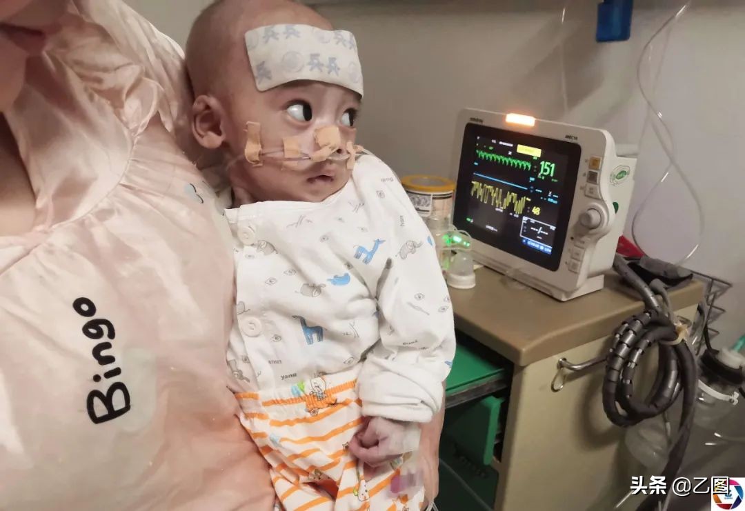 6个月的男宝才15斤,6个月的男婴体重才5公斤是正常吗