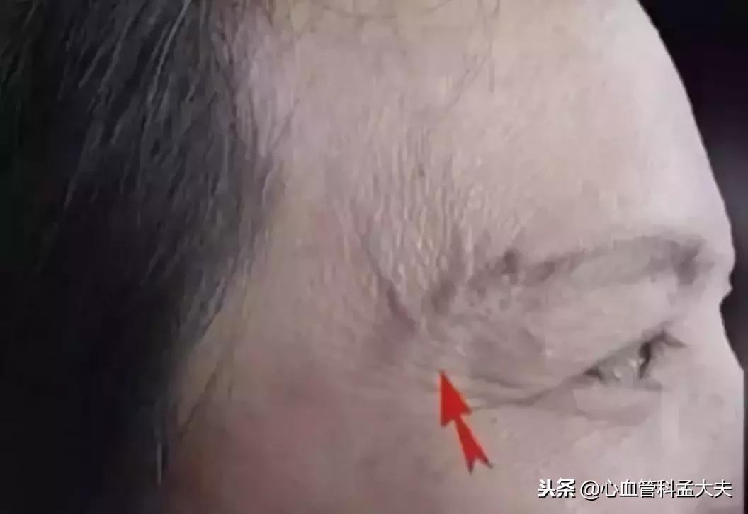 身上的青筋突然很明显是什么原因,身上青筋凸显可能是4种疾病