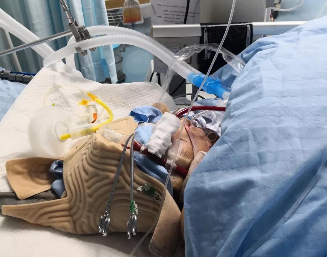 拉个肚子，心跳却突然没了！深圳“包租婆”为此两进ICU