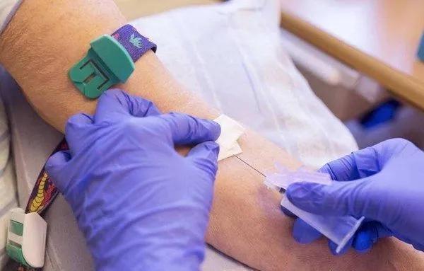 关节一热就刺痛,关节突然发热疼痛