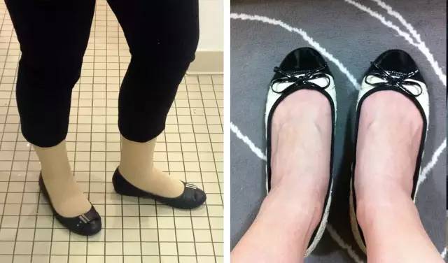 脚胖穿鞋两边鼓不好看,脚肥脚宽让鞋子变形怎么恢复原状