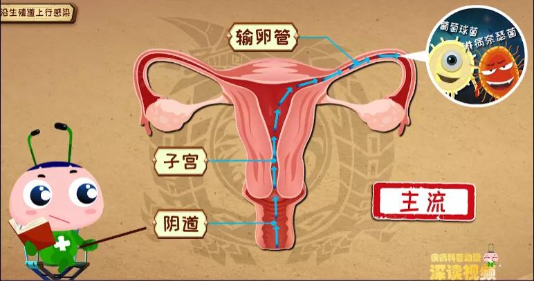 输卵管炎咋来的？*生活性**过频、人流惹的祸？看动画教你做明白女人