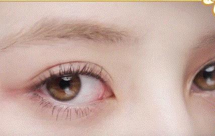 眼睛变大，这五点学会了，大眼不是梦