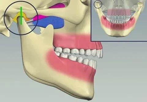 冷光美白牙齿危害亲身经历,牙齿美白科普篇