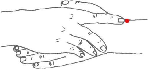 上下摇头头就痛,头重摇头疼