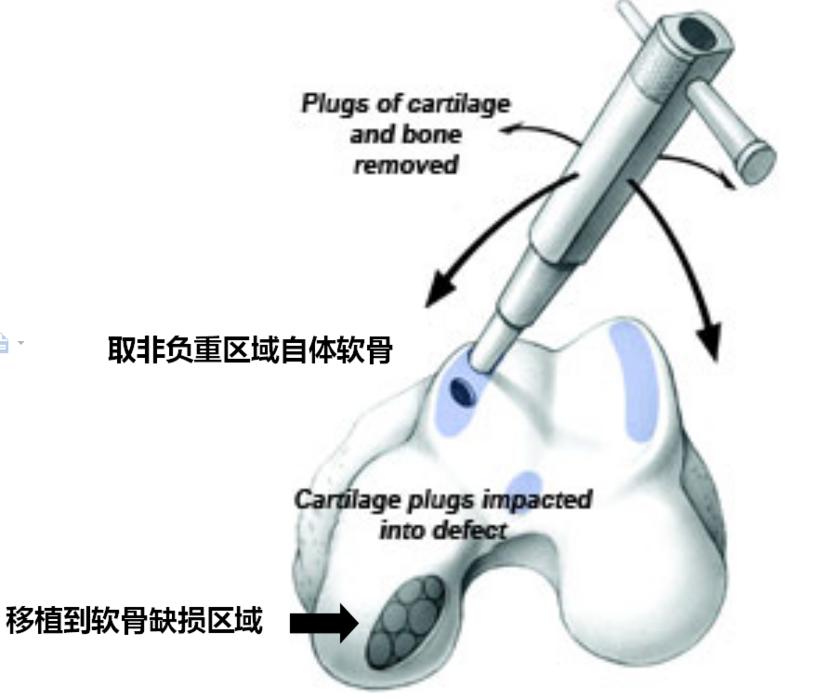 老年人骨性关节炎膝盖疼怎样锻炼,老年人膝关节骨关节炎首选检查