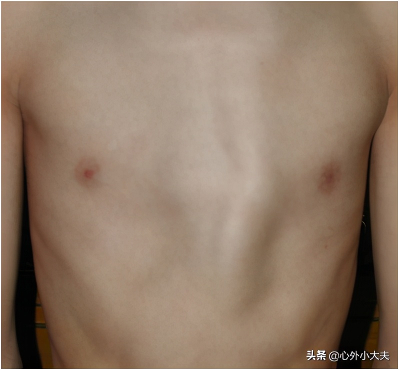 小儿外科常见疾病有哪些,儿童常见的外科疾病有哪些